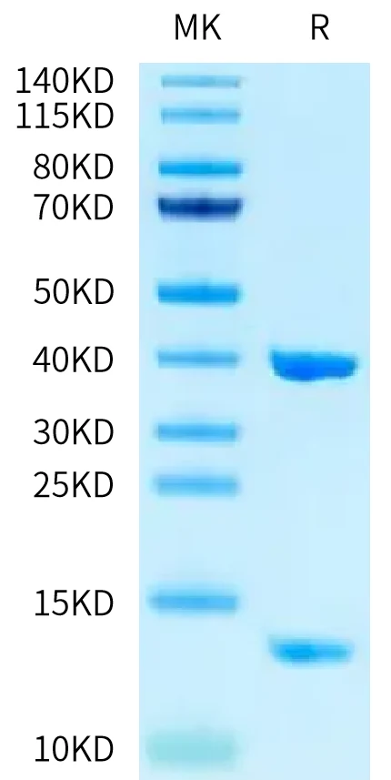 HLAA1101-HB002 Bis-Tris-PAGE-white result