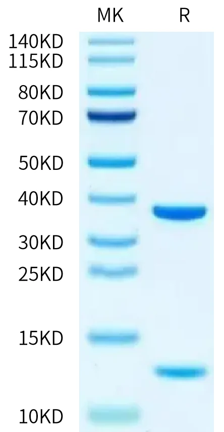 HLAA1101-HP001 Bis-Tris-PAGE-white result