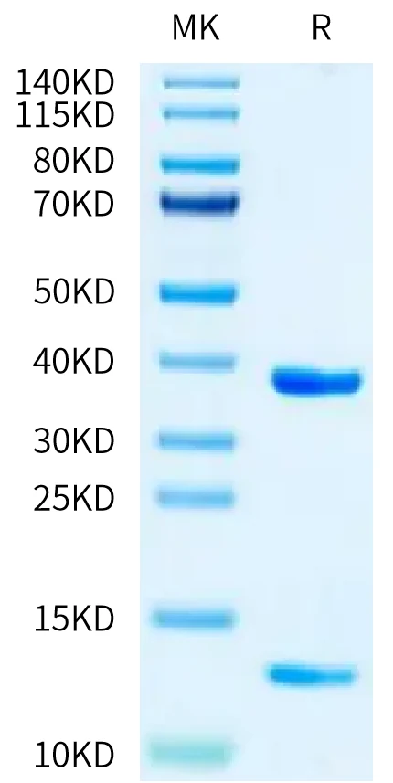 HLAA1101-HP002 Bis-Tris-PAGE-white result