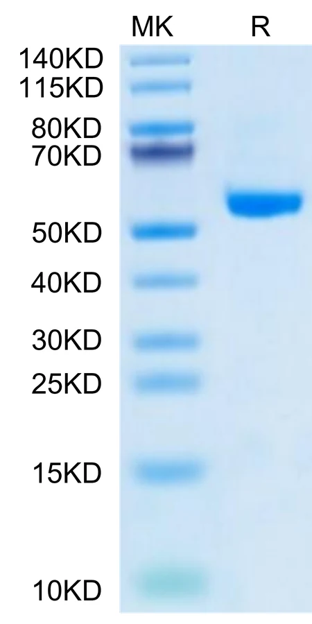 HPV16E6-HP001 Bis-Tris-PAGE-white result