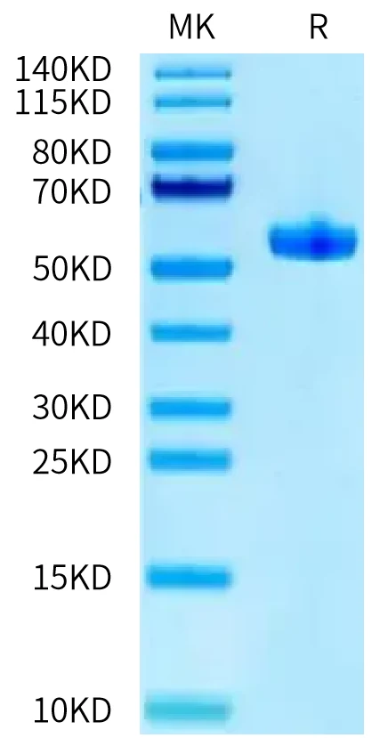 HPV16E7-HB002 Bis-Tris-PAGE-white result