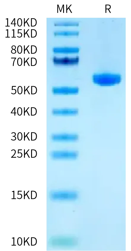 HPV16E7-HP004 Bis-Tris-PAGE-white result