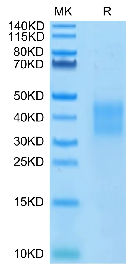 HVEM-HP001 Bis-Tris-PAGE-white result