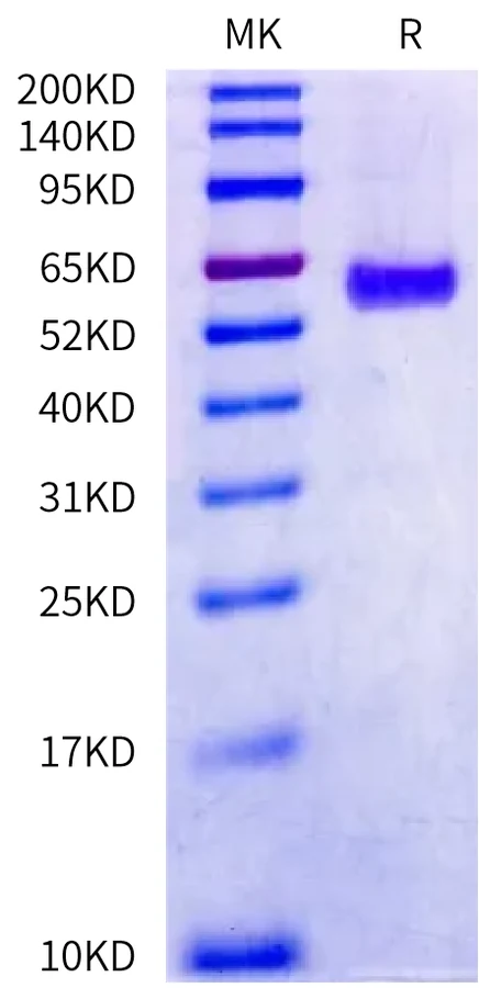 HVEM-HP002 Bis-Tris-PAGE-white result