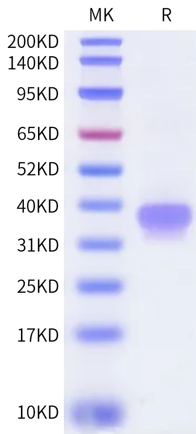IGE-CB001 Bis-Tris-PAGE-white result
