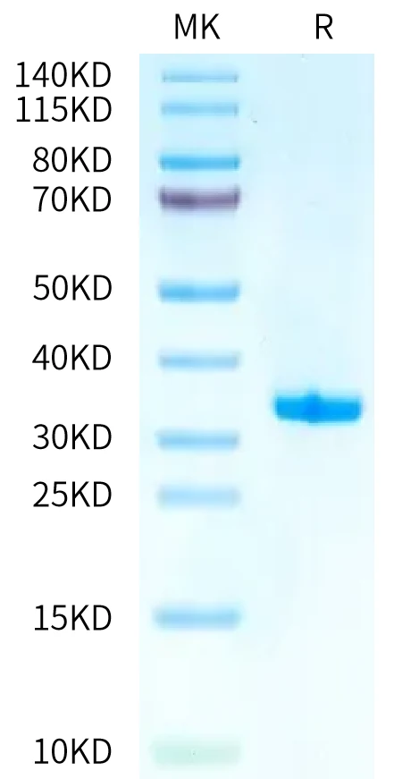 IGE-HB001 Bis-Tris-PAGE-white result