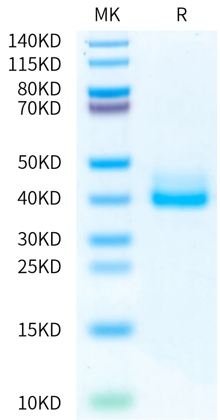 IGE-MB001 Bis-Tris-PAGE-white result