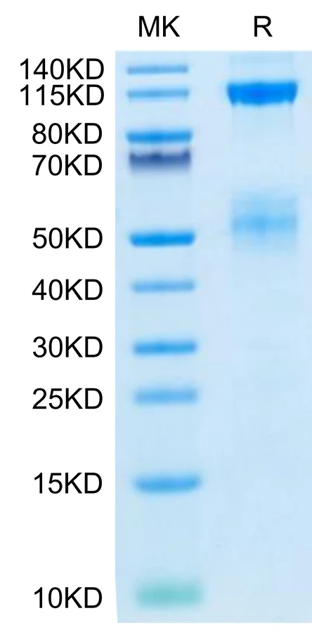 IGF1R-HB001 Bis-Tris-PAGE-white result