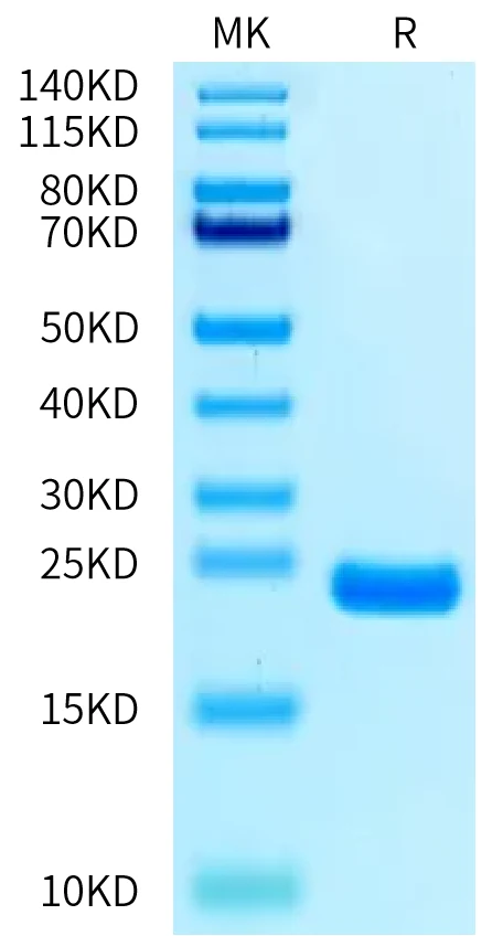 IL1-CB001 Bis-Tris-PAGE-white result
