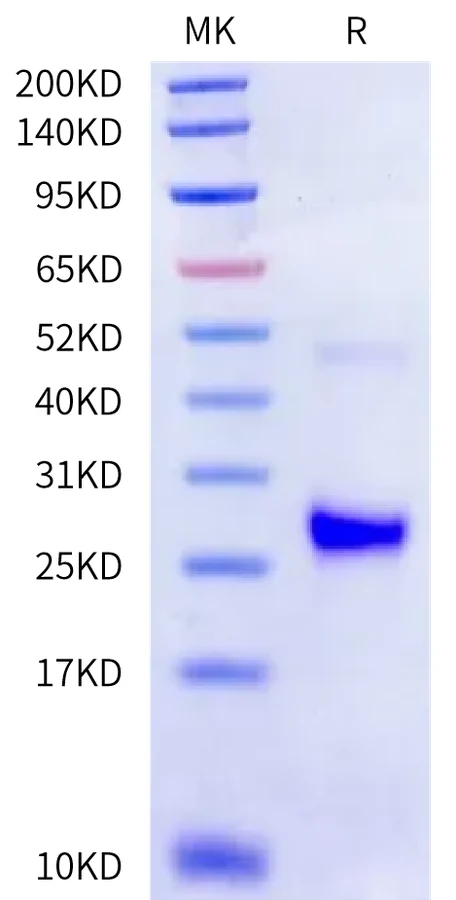 IL17F-HB001 Bis-Tris-PAGE-white result