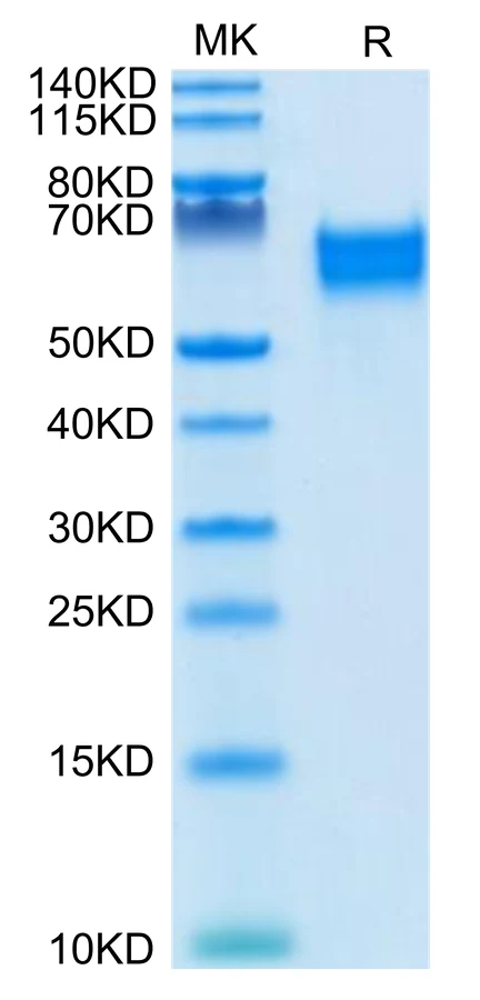 IL18-HB003 Bis-Tris-PAGE-white result