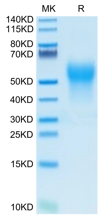 IL18BPA-HB001 Bis-Tris-PAGE-white result