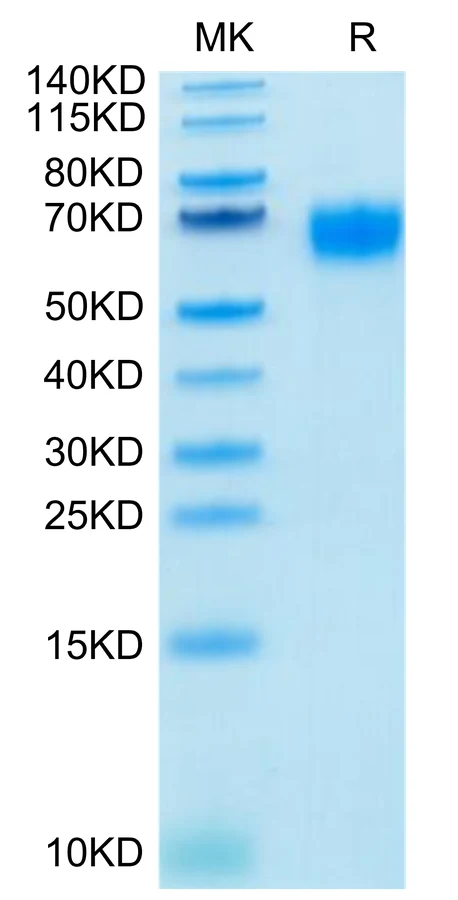 IL2-HB004 Bis-Tris-PAGE-white result