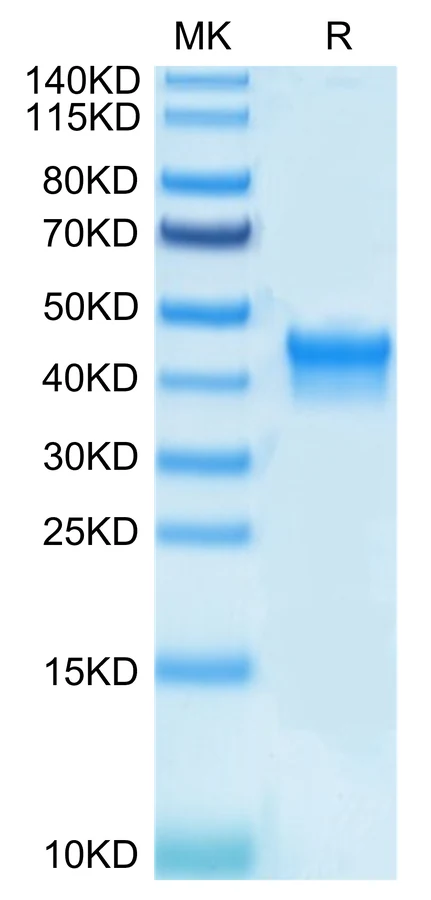 IL2-HB005 Bis-Tris-PAGE-white result