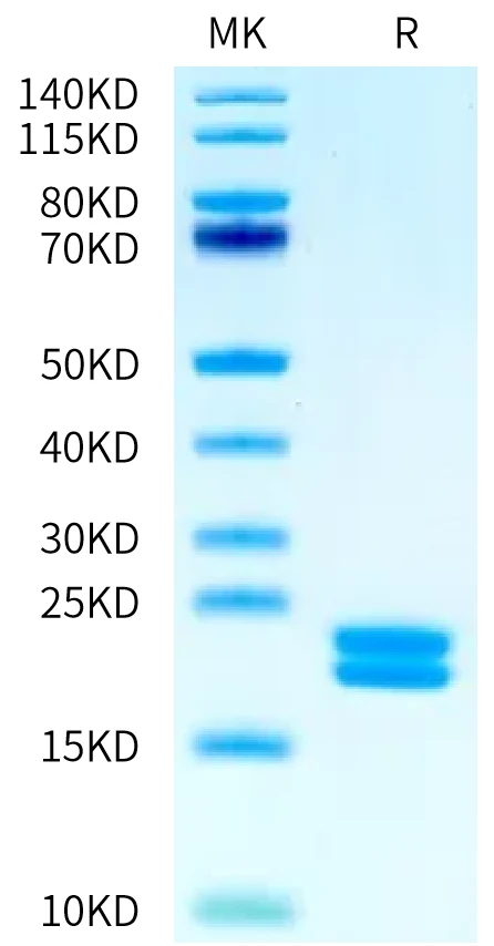 IL2-HB006 Bis-Tris-PAGE-white result