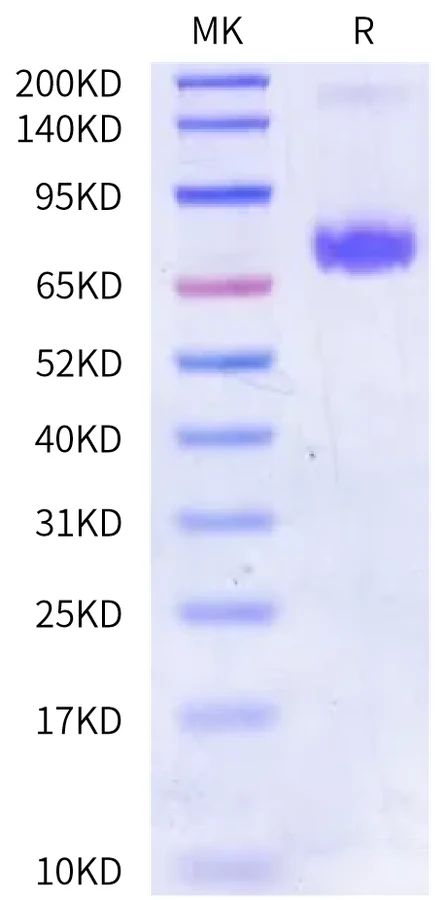 IL20RA-HF001 Bis-Tris-PAGE-white result
