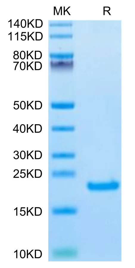 IL21-HB001 Bis-Tris-PAGE-white result