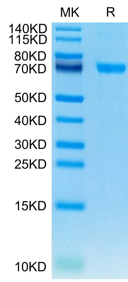 IL21R-HF001 Bis-Tris-PAGE-white result