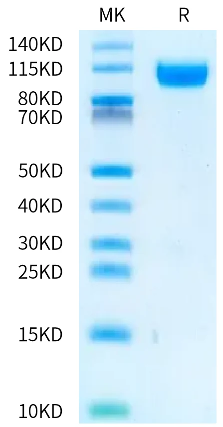 IL23R-RF001 Bis-Tris-PAGE-white result