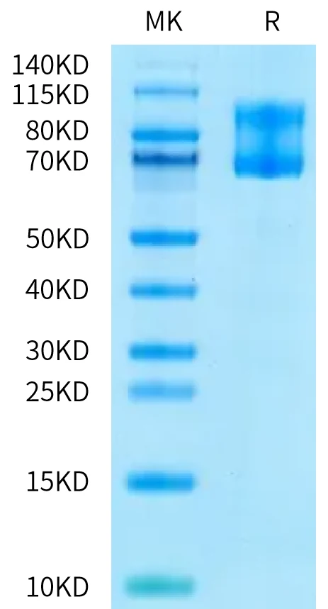 IL2RBIL2RG-HF001 Bis-Tris-PAGE-white result