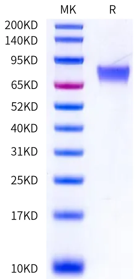 IL6-HB004 Bis-Tris-PAGE-white result
