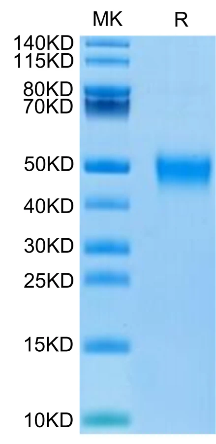 KIR2DL5-HB001 Bis-Tris-PAGE-white result