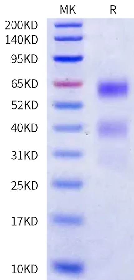 KIR3DL2-HB001 Bis-Tris-PAGE-white result
