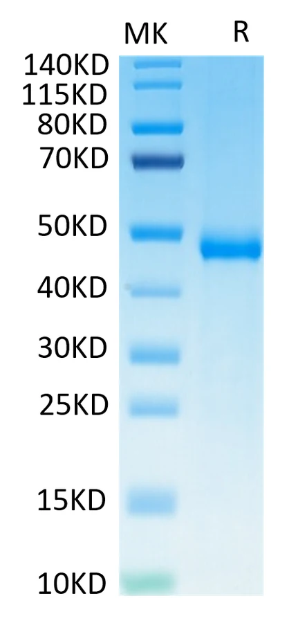 KIR3DL3-HB001 Bis-Tris-PAGE-white result