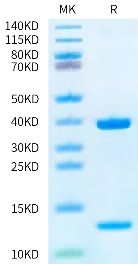 KRASG12D-HB002 Bis-Tris-PAGE-white result