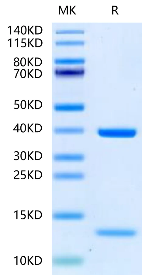 KRASG12D-HB003 Bis-Tris-PAGE-white result