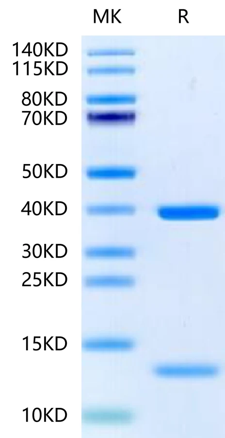 KRASG12D-HB005 Bis-Tris-PAGE-white result