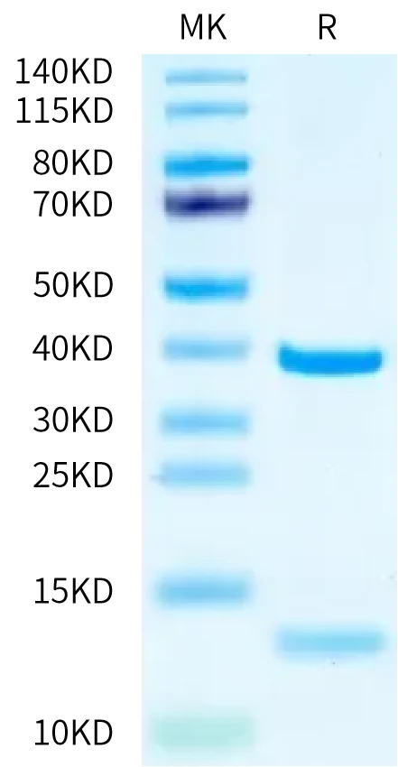 KRASG12D-HP001 Bis-Tris-PAGE-white result
