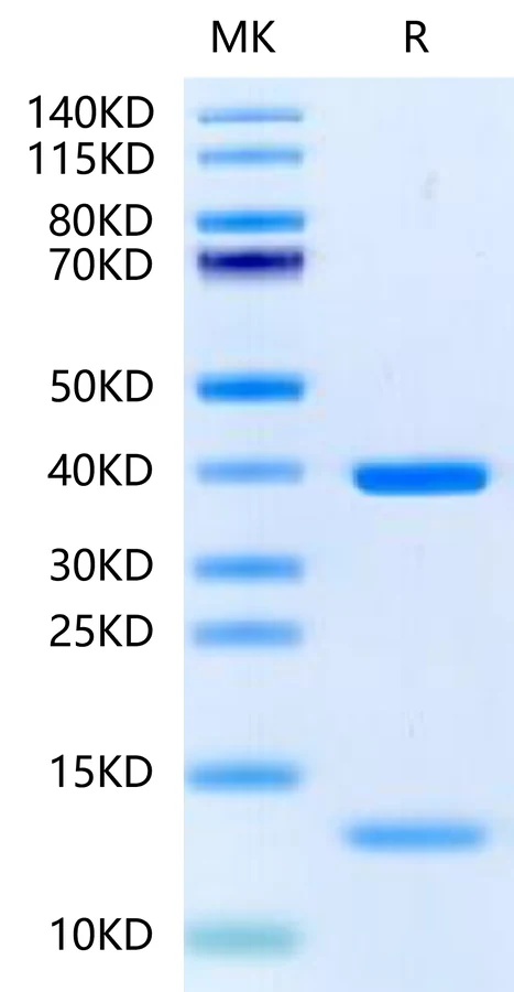 KRASG12D-HP002 Bis-Tris-PAGE-white result