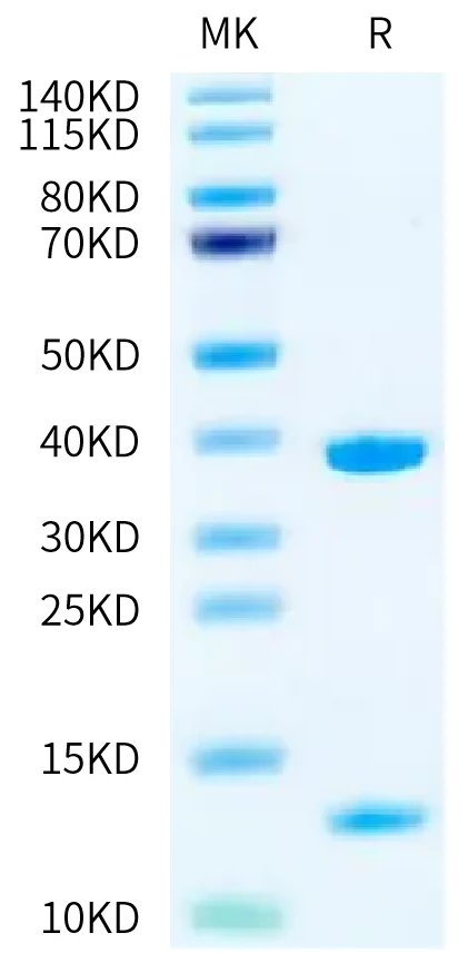 KRASG12V-HB001 Bis-Tris-PAGE-white result