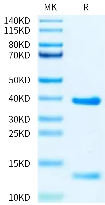 KRASG12V-HB002 Bis-Tris-PAGE-white result