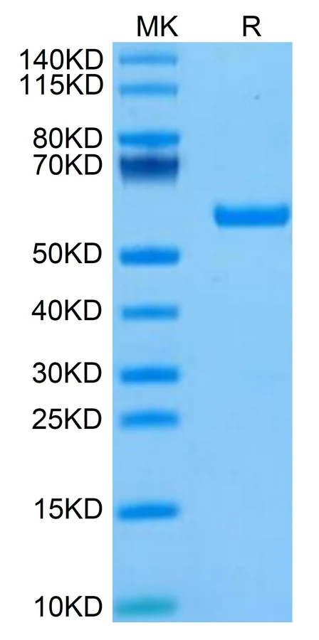 KRASG12V-HB004 Bis-Tris-PAGE result