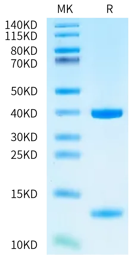 KRASG12V-HB005 Bis-Tris-PAGE-white result