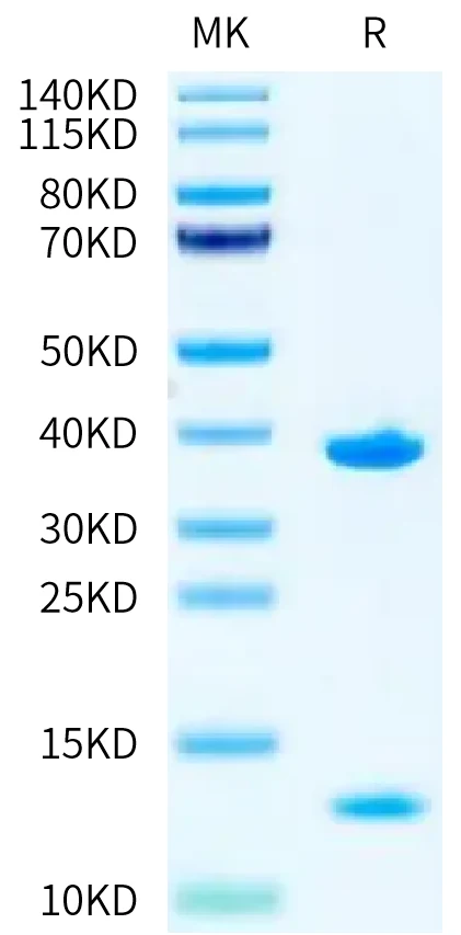 KRASG12V-HB006 Bis-Tris-PAGE-white result