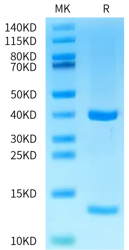 KRASG12V-HP001 Bis-Tris-PAGE-white result