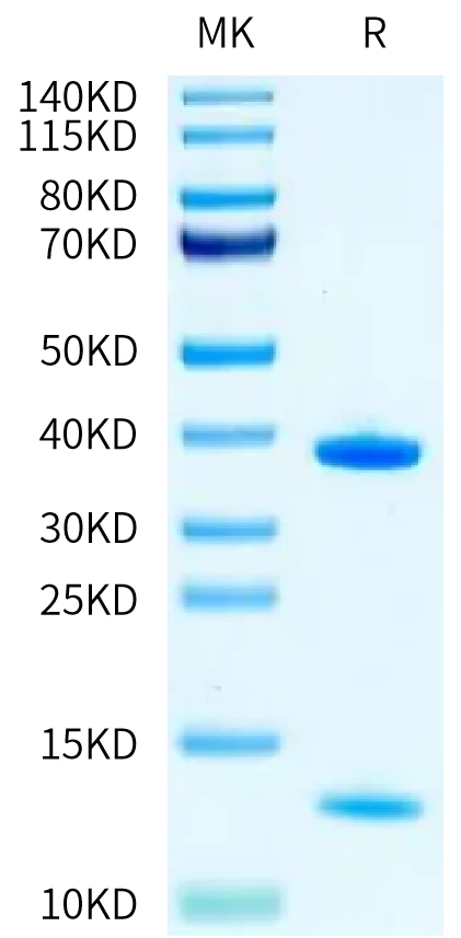 KRASG12V-HP005 Bis-Tris-PAGE-white result