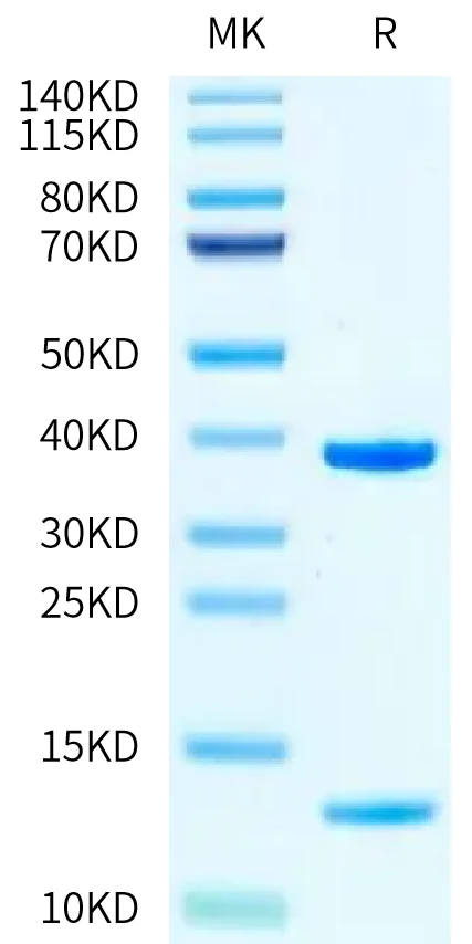 KRASG12V-HP007 Bis-Tris-PAGE-white result