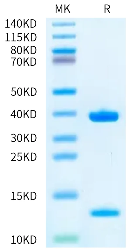 KRASWT-HB001 Bis-Tris-PAGE-white result