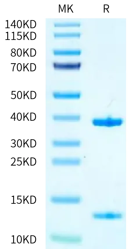 KRASWT-HB005 Bis-Tris-PAGE-white result