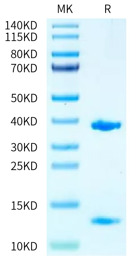 KRASWT-HB006 Bis-Tris-PAGE-white result
