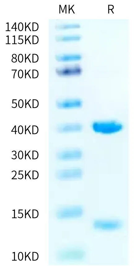 KRASWT-HB007 Bis-Tris-PAGE-white result
