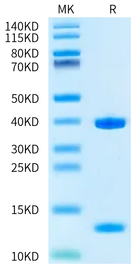 KRASWT-HB008 Bis-Tris-PAGE-white result