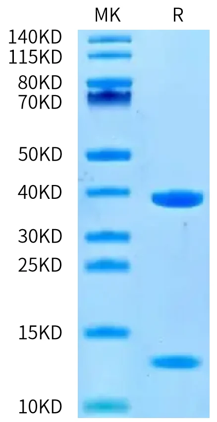 KRASWT-HP001 Bis-Tris-PAGE-white result