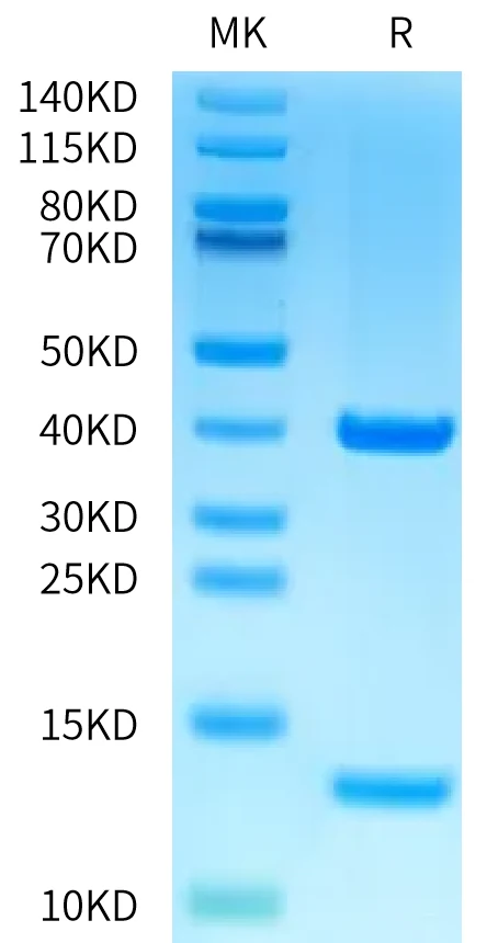 KRASWT-HP002 Bis-Tris-PAGE-white result