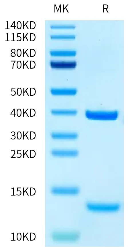 KRASWT-HP003 Bis-Tris-PAGE-white result