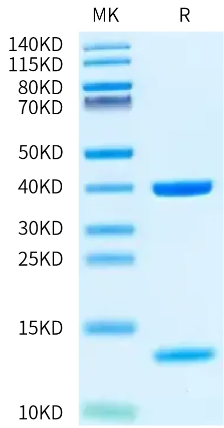 KRASWT-HP006 Bis-Tris-PAGE-white result